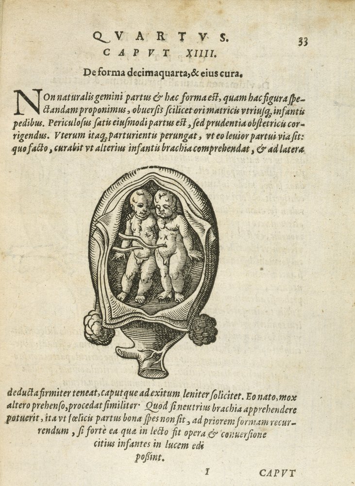 Nicht-identische Zwillinge im Mutterleib, Illustration aus Kapitel 14, Buch 4 von Über die Empfängnis und das Wachstum des Menschen von Rueff, 1587 von German School