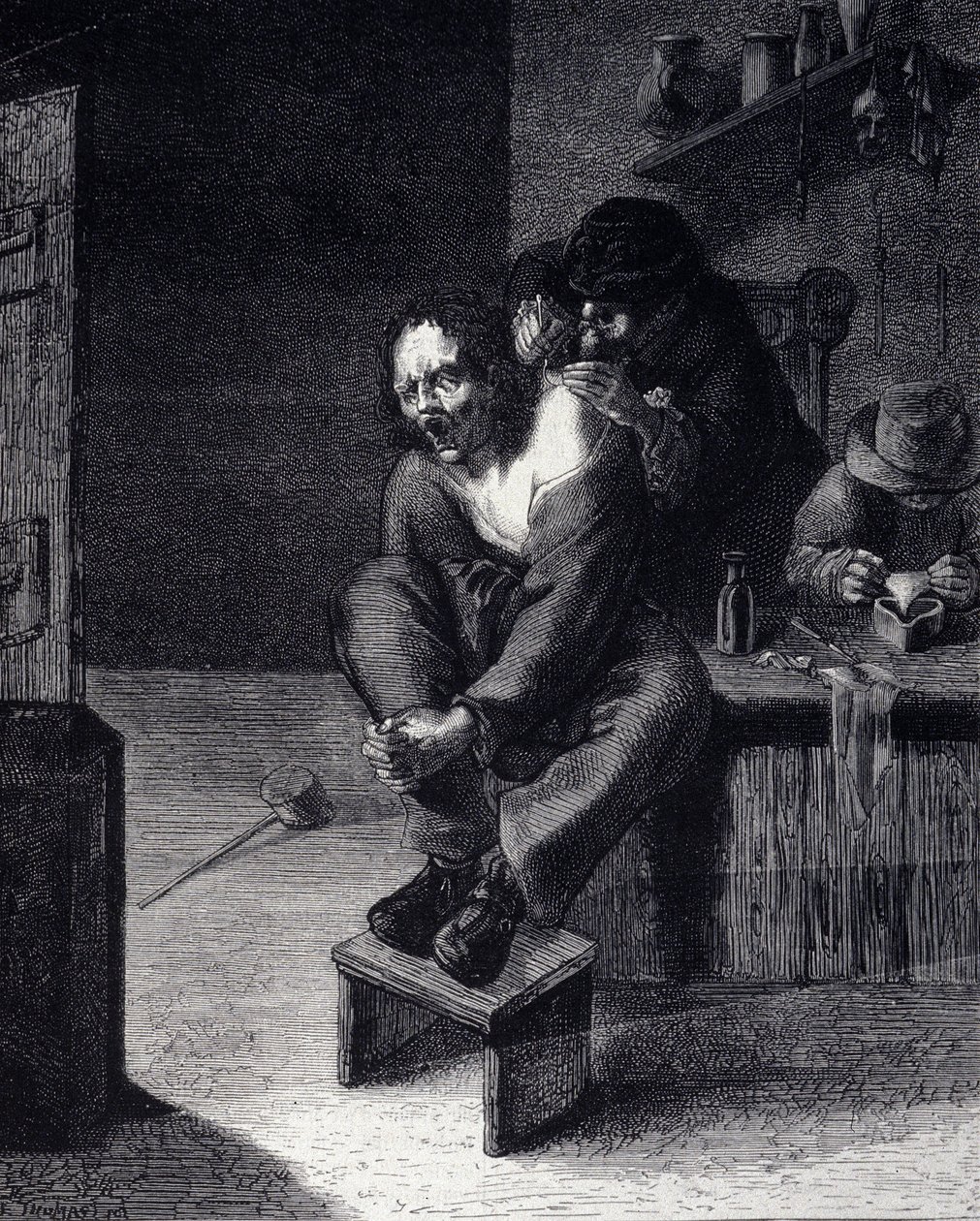Die chirurgische Operation. Gravur nach einem Gemälde von Adrien Brauwer (gestorben 1608) 17. Jahrhundert von Adriaen (after) Brouwer