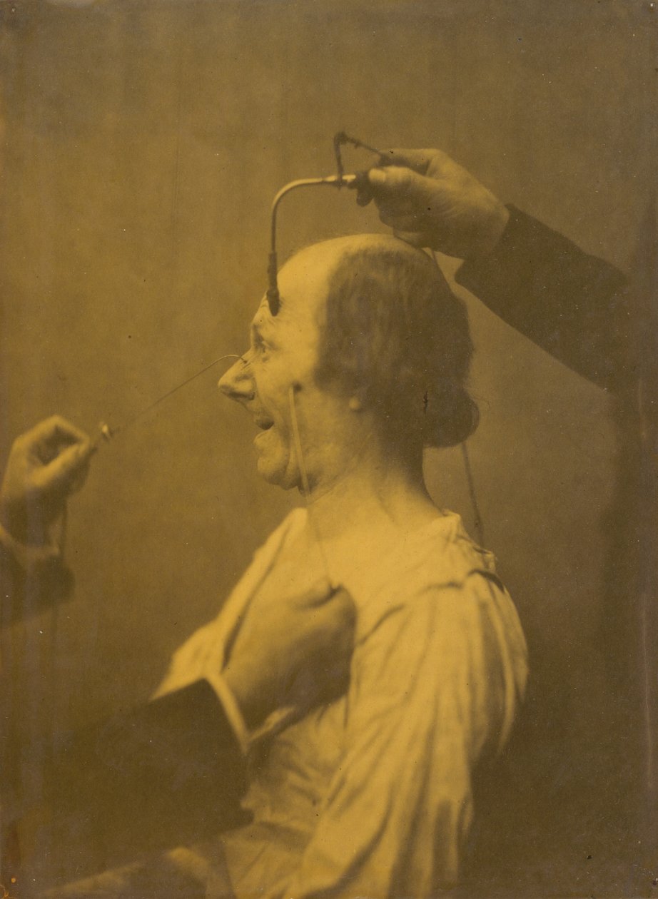 Die Aufmerksamkeit, die durch ein Objekt erregt wird, das laszive Ideen und Wünsche hervorruft, 1854-1856 von Duchenne de Boulogne