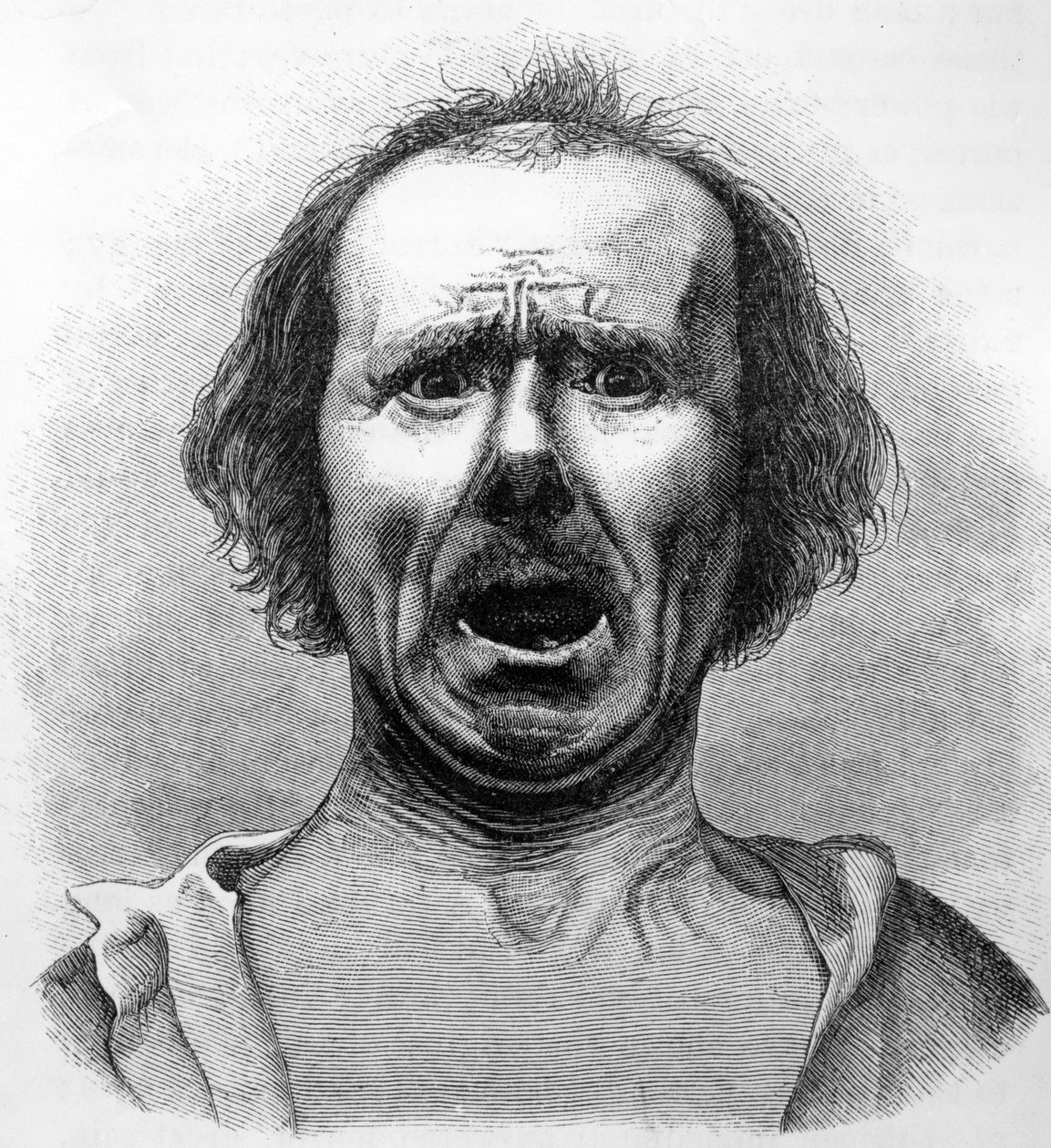Horror und Agonie, kopiert von einem Foto von Dr. Duchenne, Illustration aus 