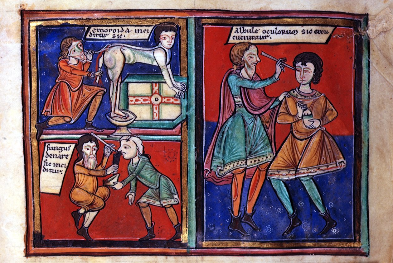 Sloane Ms 1975 fol.93 Medizinische Operationen von English School
