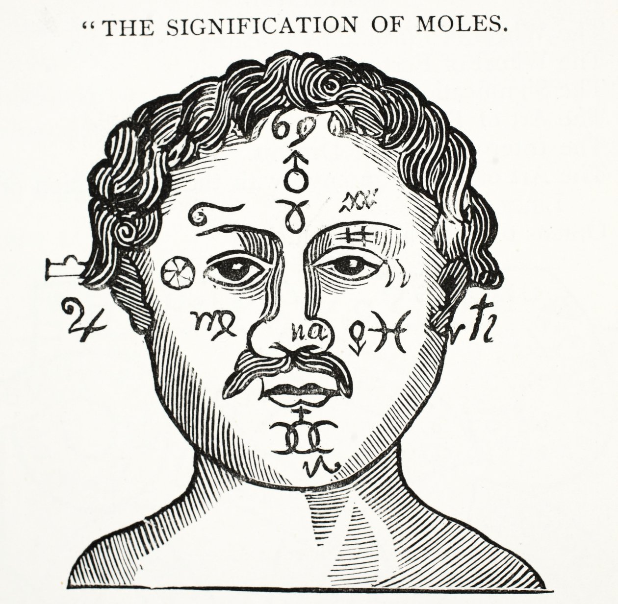 Die Bedeutung von Muttermalen, Illustration aus Chap-books of the Eighteenth Century von John Ashton, veröffentlicht 1882 von English School