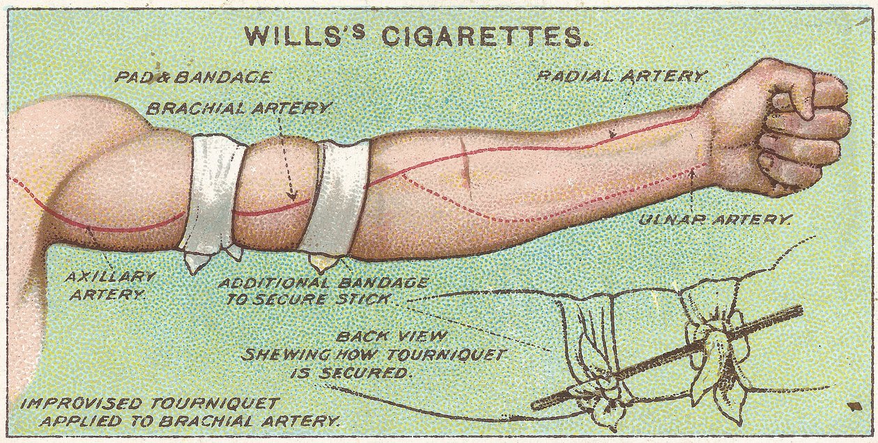 Tourniquet, Nr. 11 aus der Erste-Hilfe-Serie von Willss Zigarettenkarten, 1913 von English School