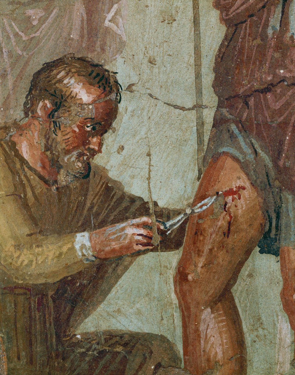 Verwundeter Aeneas zwischen Venus und Ascanius von Erich Lessing