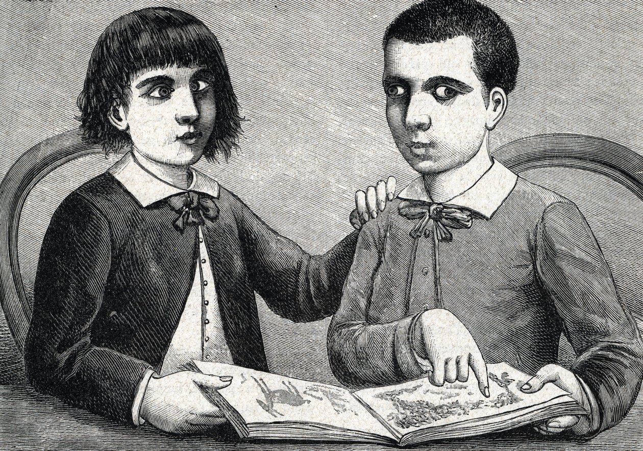 Kinder mit konvergentem und divergentem Strabismus oder Schielen (Gravur) 1888 von French School