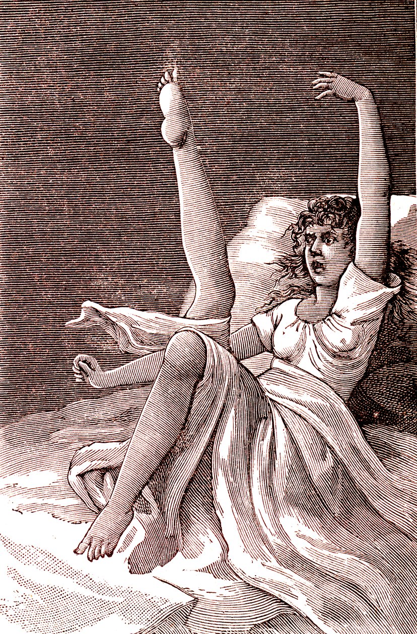 Hysterie, ein extrem mentales Phänomen, Psychosen und Psychoneurosen. 1887 (Gravur) von French School