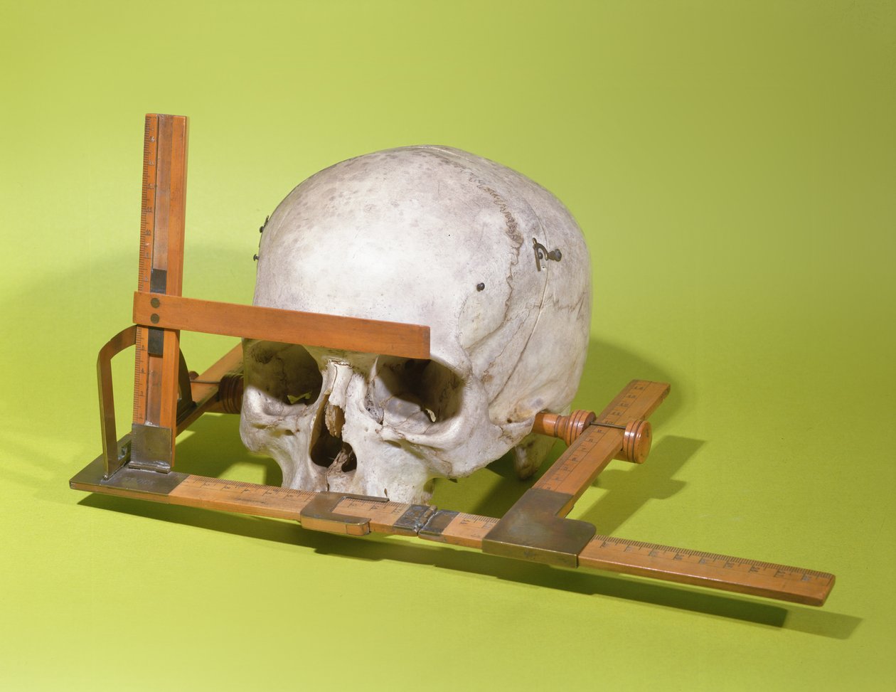 Schädel in einem Gesichtsgoniometer, konstruiert von Paul Broca (1824-88) von French School