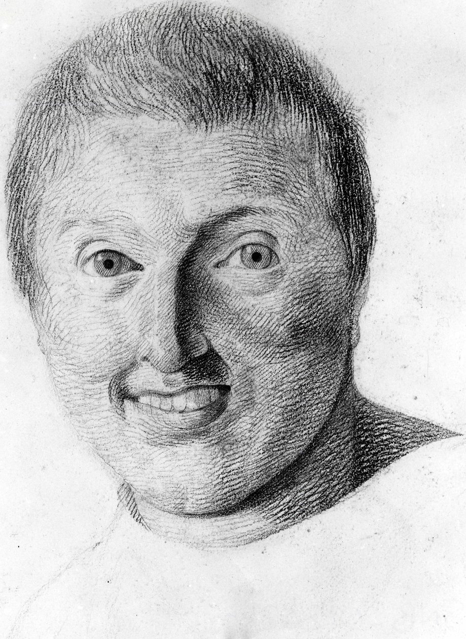 Ein Epileptiker - in „Etude de la physiognomy des aliénés“, Zeichnung von Gabriel von Georges Francois Gabriel