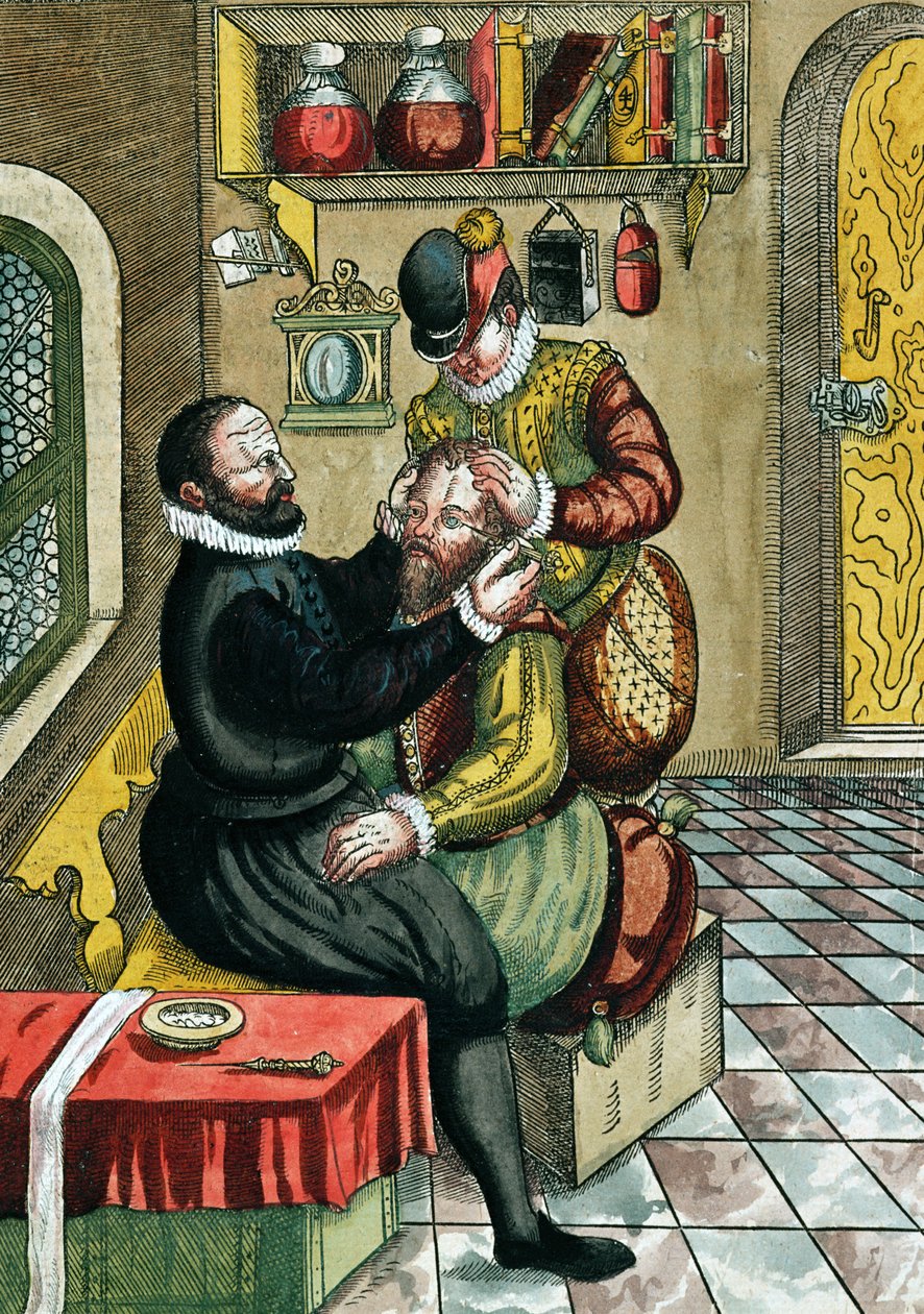 Kataraktoperation, aus Ophthalmodouleia von Georg Bartisch, veröffentlicht in Dresden 1583 von German School