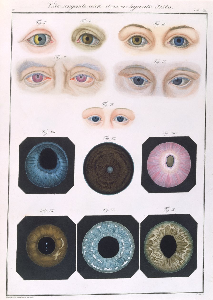 Beschreibung angeborener Augenanomalien, aus Klinische Darstellungen der Krankheiten und Bildungsfehler des menschlichen Auges, von Friedrich August von Ammon (1799-1861) 1838 von German School