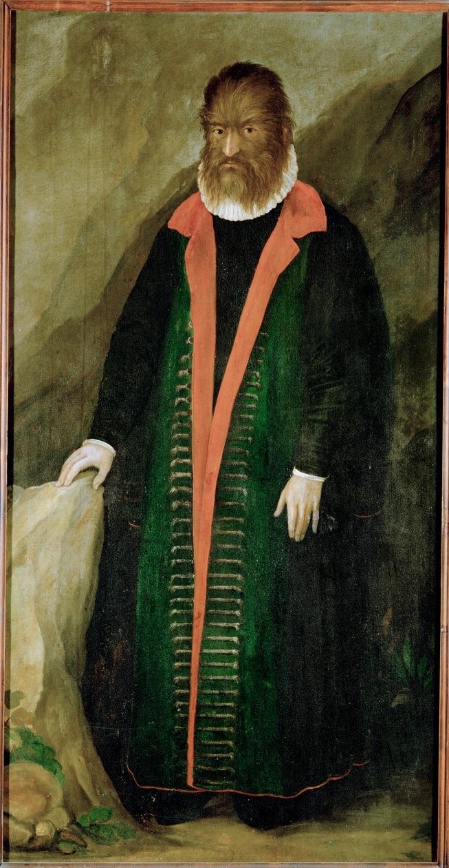 Der haarige Mann, Petrus Gonzalvus, geboren 1556 auf Teneriffa von German School