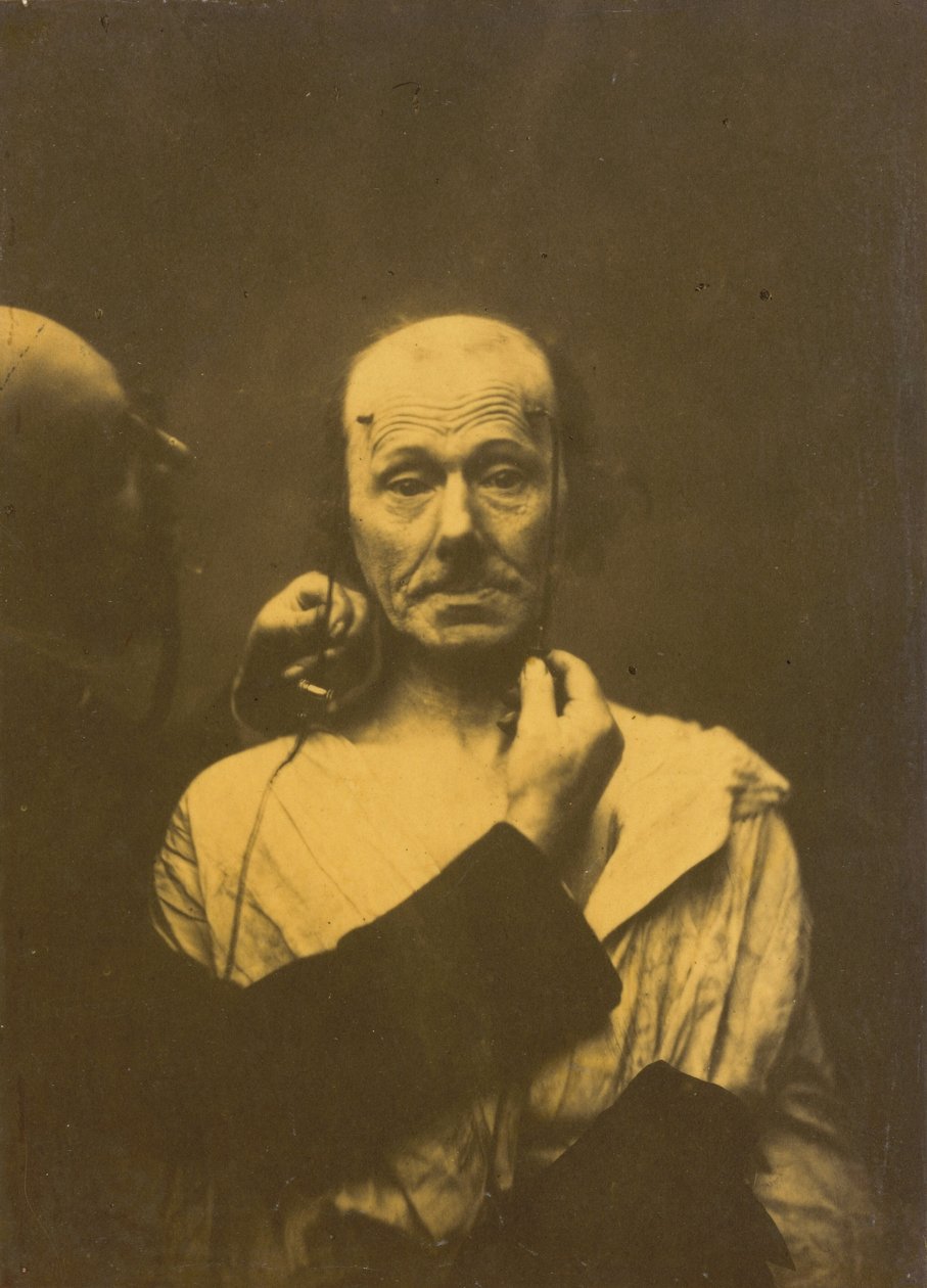 Aufmerksamkeit, 1854-1856, gedruckt 1862 von Guillaume-Benjamin-Armand Duchenne de Boulogne