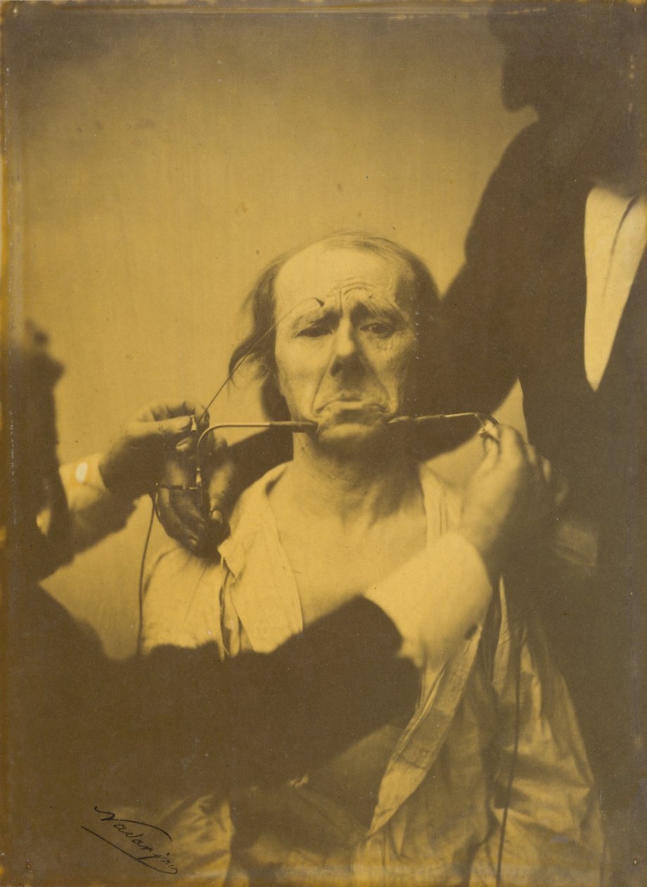 Schmerz und Verzweiflung, 1854-1856, gedruckt 1862 von Guillaume Benjamin Armand Duchenne de Boulogne