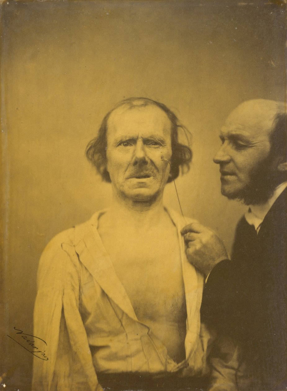 Weinen, Tränen des Mitleids (links); Entspanntes Gesicht (rechts), 1854-1856, gedruckt 1862 (Foto) von Guillaume Benjamin Armand Duchenne de Boulogne