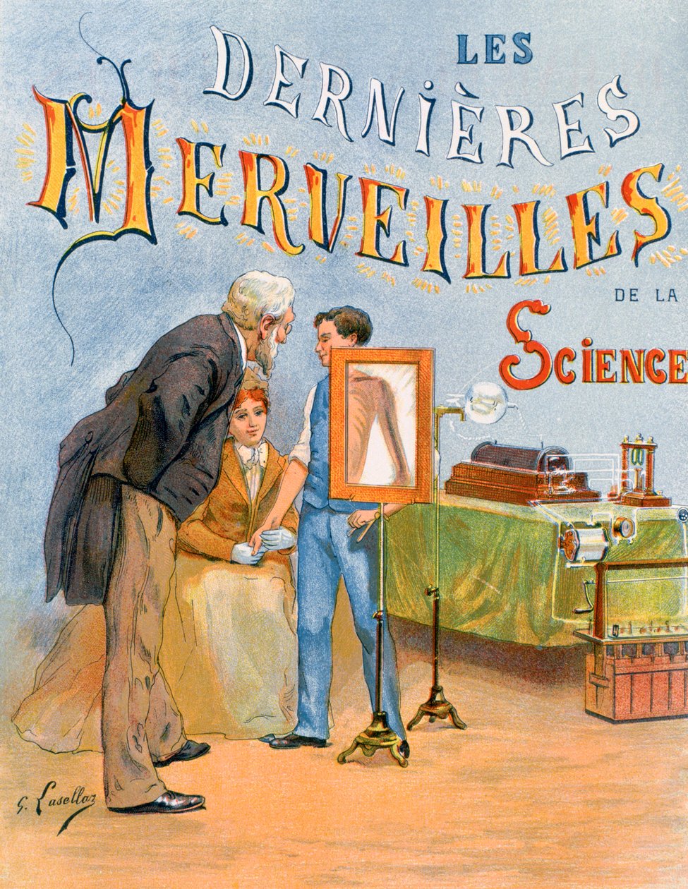 Die Untersuchung eines Kinderarms durch Radiographie, 19. Jahrhundert von Gustave Francois Lasellaz