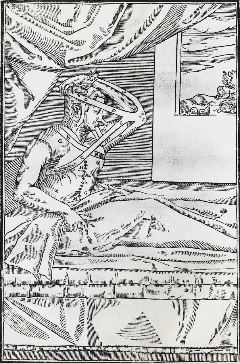 Rhinoplastik-Operation, bei der die Nase des Patienten an eine Hautklappe am Oberarm angeschlossen wurde von Italian School