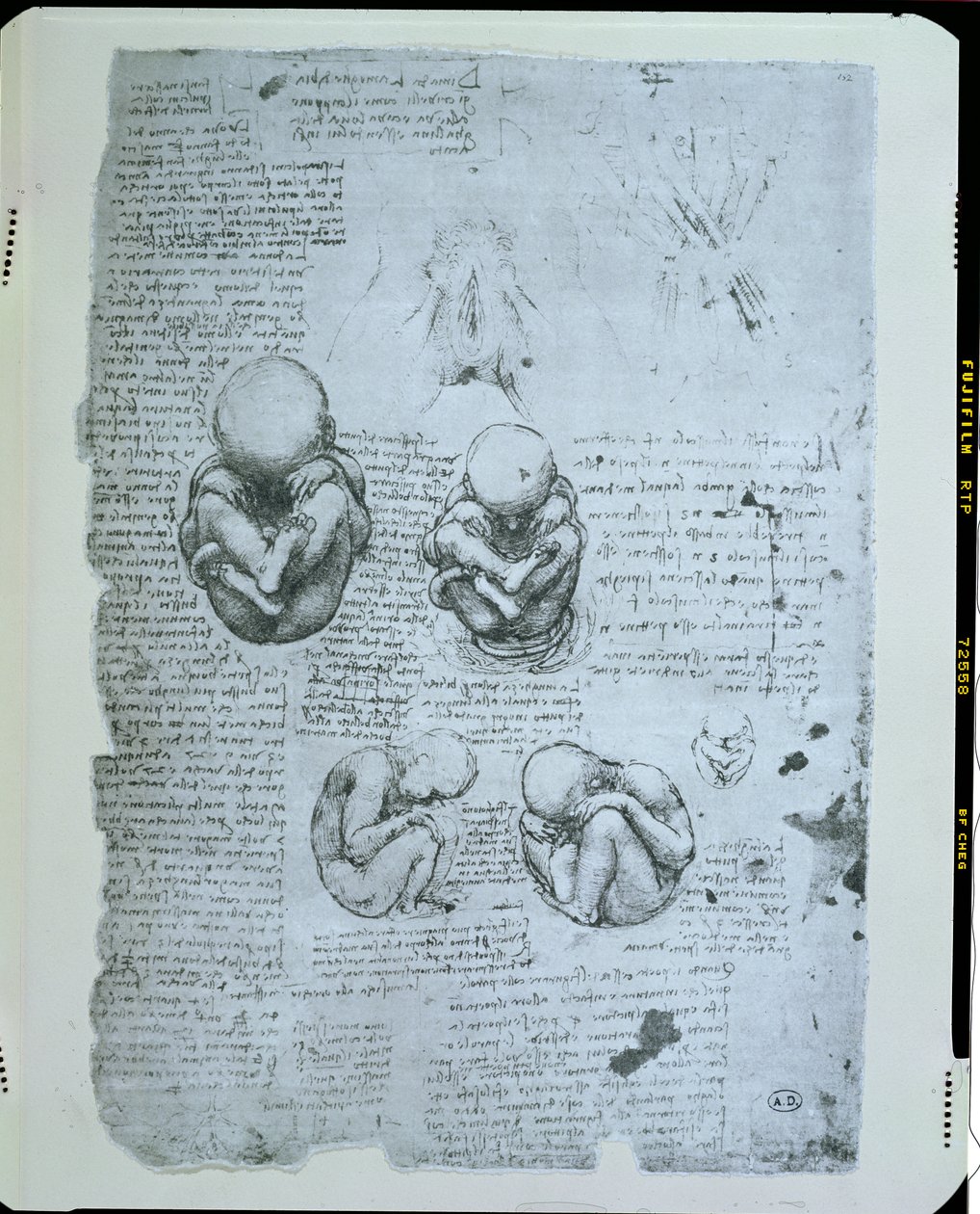 Fünf Ansichten eines Fötus im Mutterleib, Faksimilekopie von Leonardo da Vinci