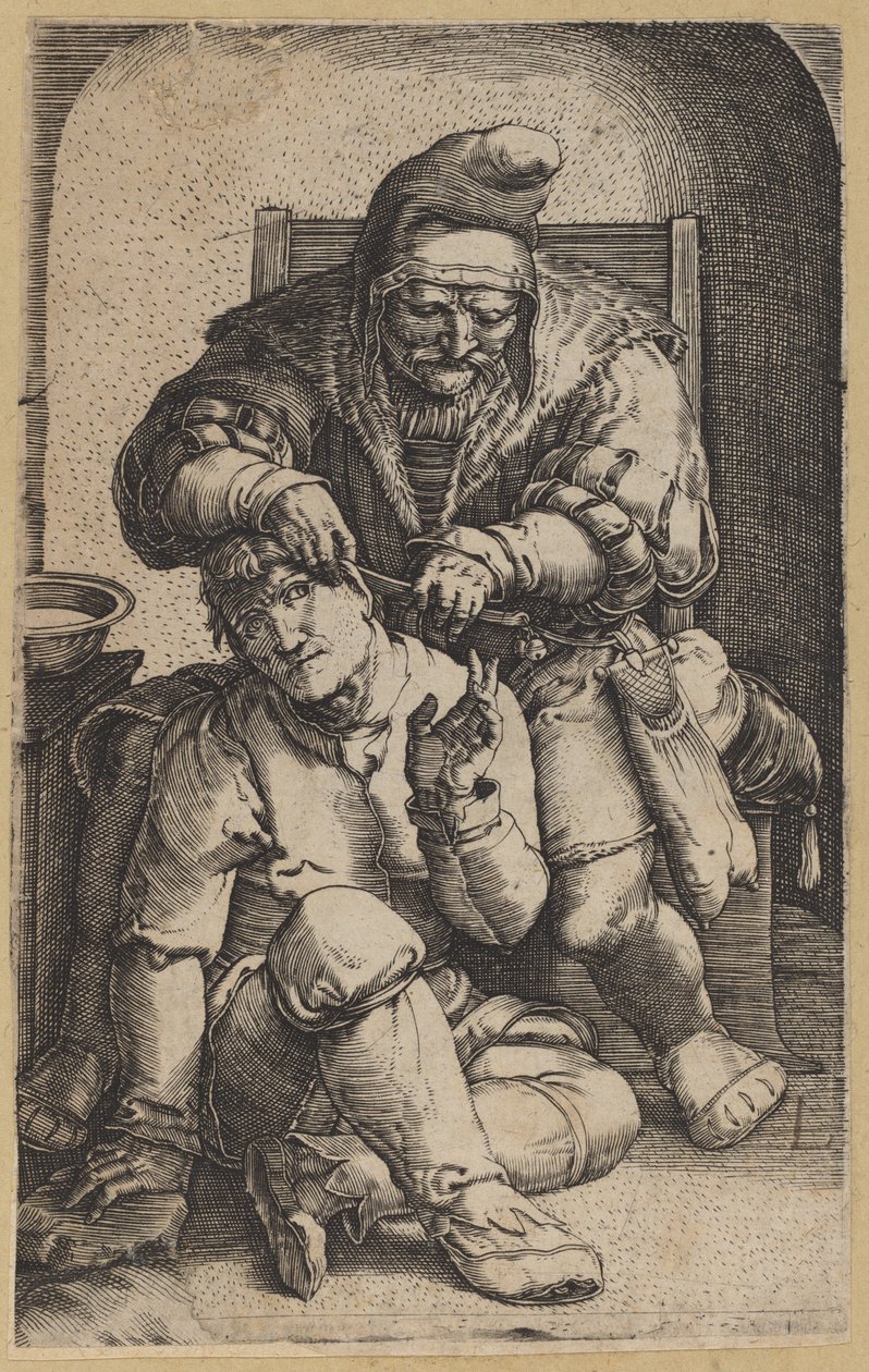 Der Chirurg (umgekehrte Kopie) von Netherlandish 16th Century, after Lucas van Leyden