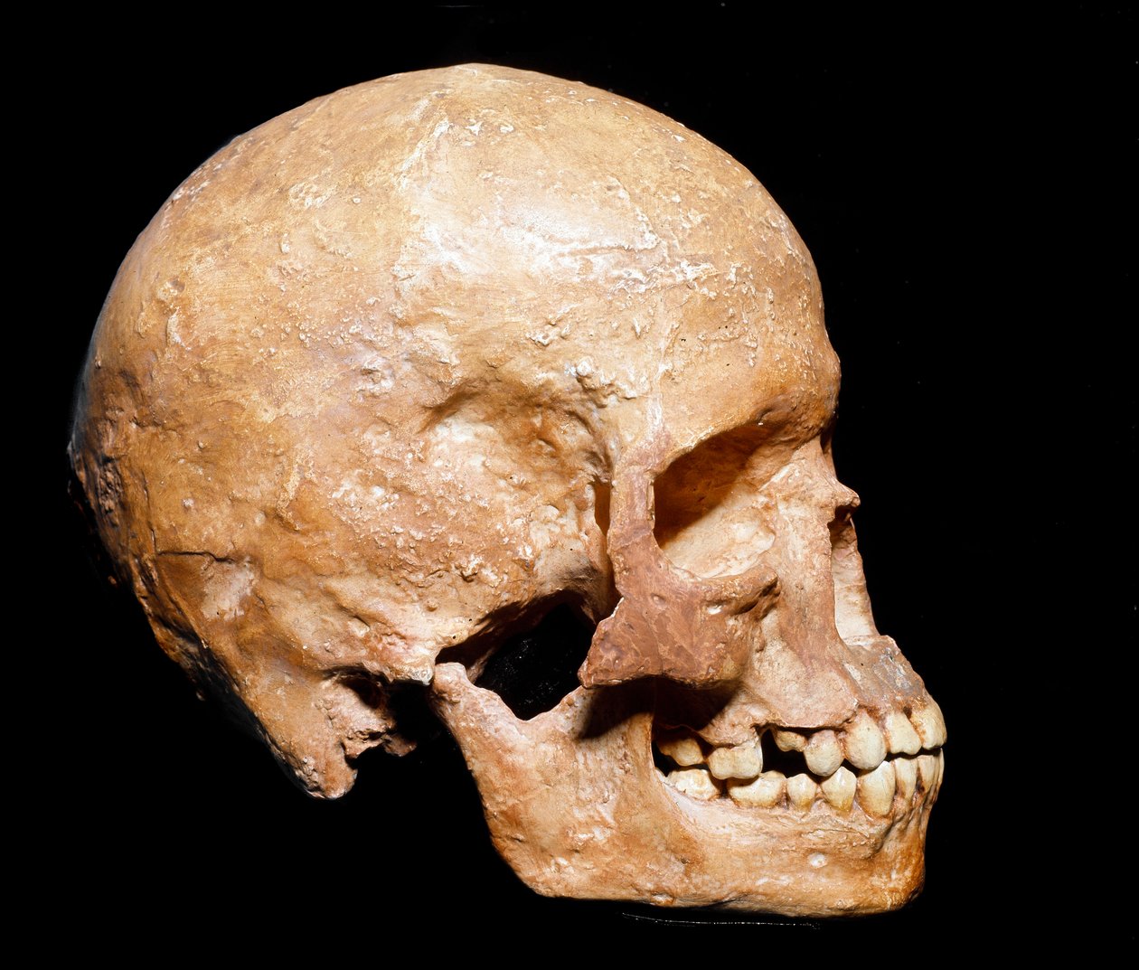 Vorgeschichte: Fossiler Schädel von Homo sapiens aus Grimaldi. Kultur des Aurignacien, Oberes Paläolithikum. Museo Civico di Storia Naturale, Mailand von Prehistoric Prehistoric