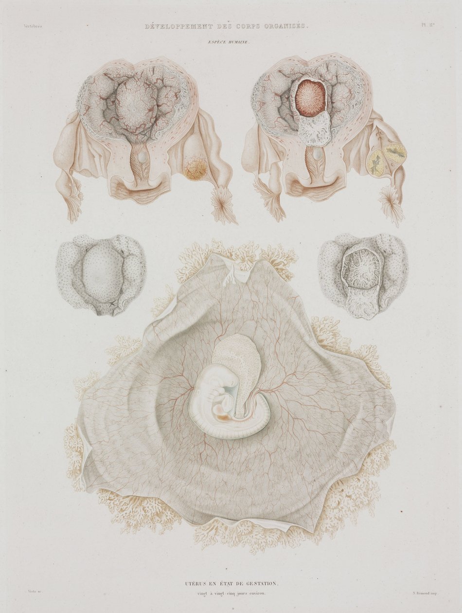 Gynäkologie: Menschliche Gebärmutter mit Embryo, ca. 1847-1859 von John Pardon
