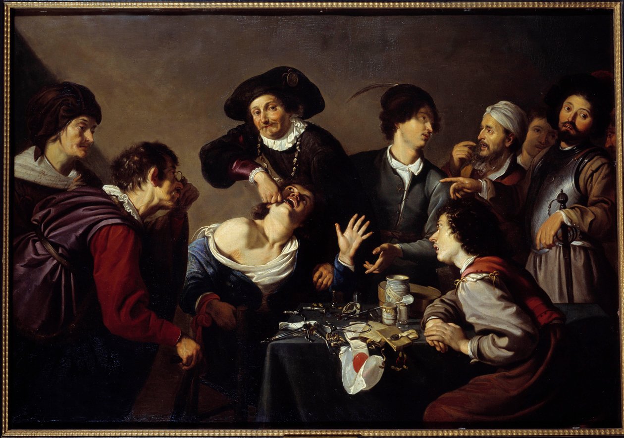 Der Zahnzieher von Theodor Rombouts: Kunstdruck kaufen