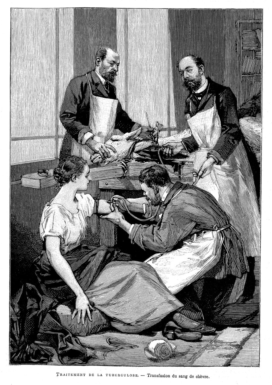 Ein Tuberkulosepatient erhält eine Bluttransfusion von einer Ziege, 1891 von Unbekannt