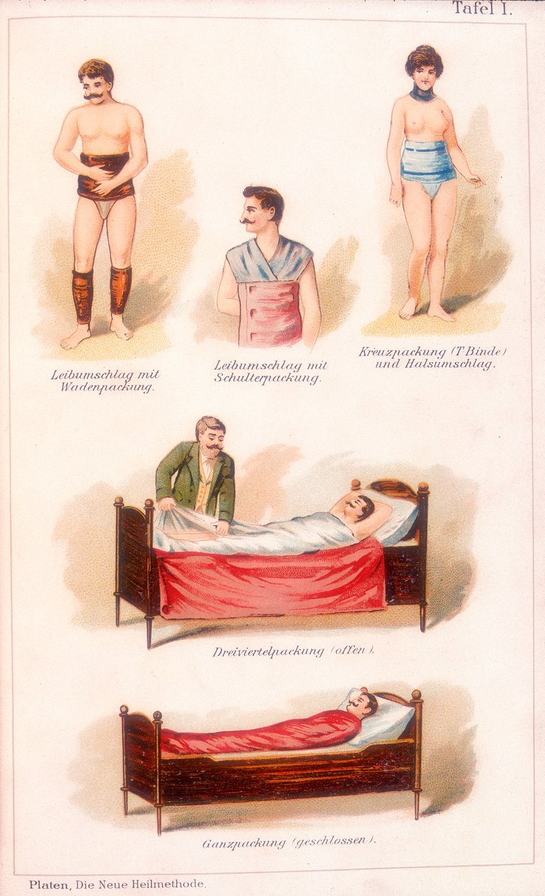 Hydrotherapie-Behandlungen, ca. 1902 von Unbekannt