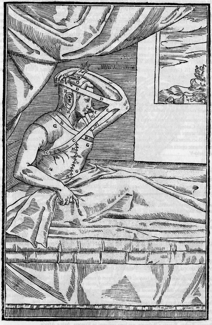 Nasenchirurgie: Rekonstruktive Chirurgie an der Nase in „De curtorum chirurgia per insitionem“. Venedig von Unknown artist