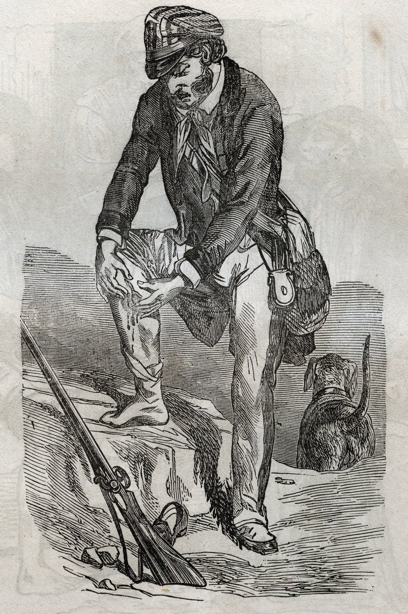 Tollwut - Behandlung von Bissen durch ein tollwütiges Tier - Verletzungen, die seine Wunde drücken - Gravur in „La Sante Universelle - Guide Medical des Familles“ 1852 von Unknown artist