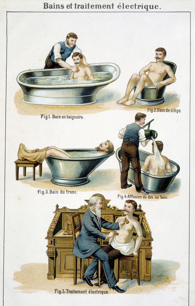 Bäder und elektrische Behandlung: 1) Badewanne, 2) Sitzbad, 3) Rumpfbad, 4) Rückenbad, 5) Elektrische Behandlung - in „Bilz, Naturheilkunde“, Ende des 19. Jahrhunderts von Unknown artist