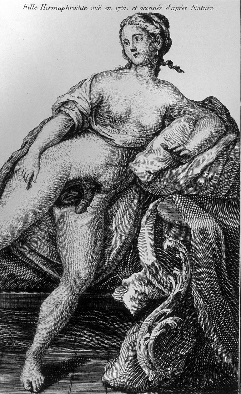 Hermaphroditisches Mädchen, gesehen 1751 und nach der Natur gezeichnet von Unknown artist