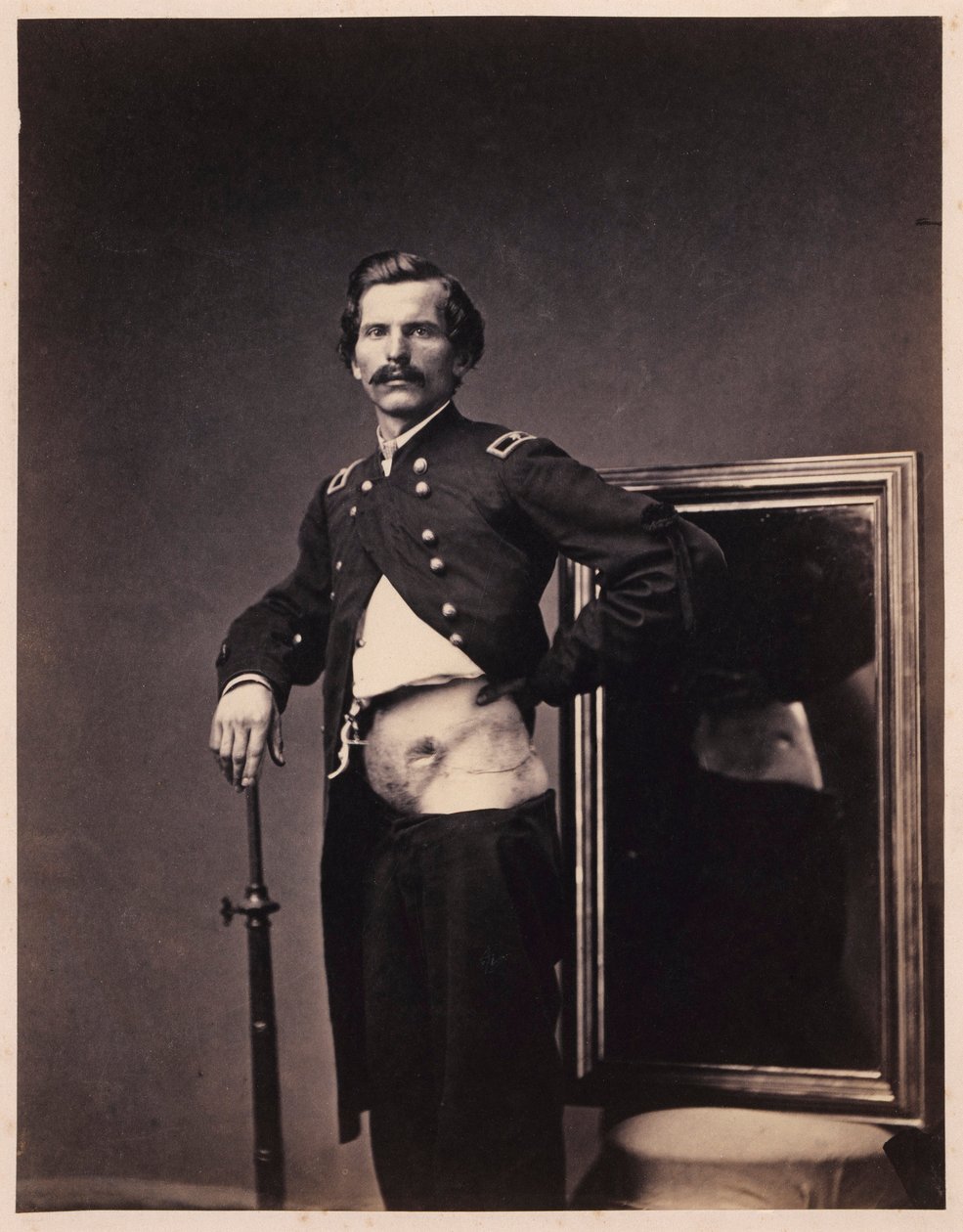 Major H. A. Barnum, Genesung nach einer durchdringenden Schusswunde des Bauches mit Perforation des linken Iliums, aus dem fotografischen Katalog der chirurgischen Abteilung von William Bell