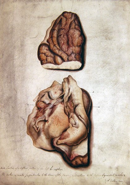 Studie des Gehirns III, um 1850 von William Lover