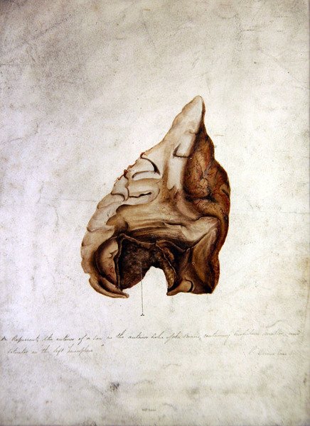 Studie des Gehirns I, ca. 1850 von William Lover