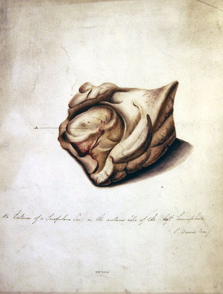 Studie des Gehirns II, ca. 1850 von William Lover