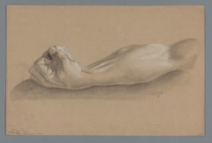 Gipsmodell eines Arms mit geballter Faust