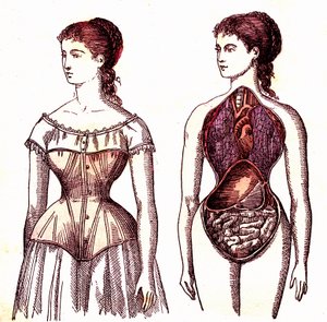 Korsettkompression - Normales Leben und Gesundheit von J. Rengade. Zeichnung A. Demarle 1881 von Alphonse Demarle