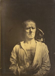 Krampf des m. corrugator supercilii unter sehr starkem Licht links, Ein entspanntes Gesicht..., 1854-1855