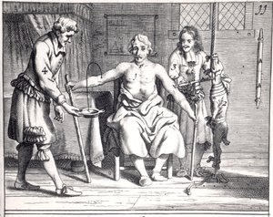 Bluttransfusion von einem Hund, aus Armamentarii Chirurgici von Johannes Schultes, veröffentlicht in Amsterdam, 1671
