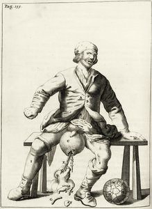 Abfluss von Flüssigkeit aus einem Hydrozele des Hodensacks, aus Exercitationes Practicae circa Medendi Methodum von Frederik Dekkers, 1694
