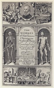 A Pare, Die Werke, T Cotes und R Young 1634