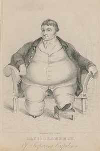 Daniel Lambert, von erstaunlicher Korpulenz