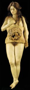 Anatomisches Modell einer Eileiterschwangerschaft