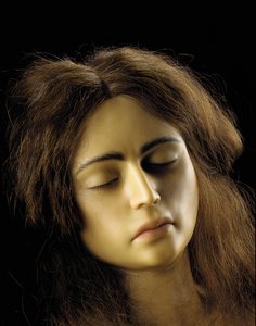 Anatomisches Modell einer Eileiterschwangerschaft (Detail)