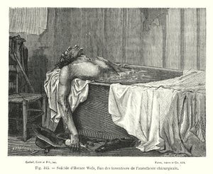 Selbstmord von Horace Wels, einem der Erfinder der chirurgischen Anästhesie (Stich) von European School