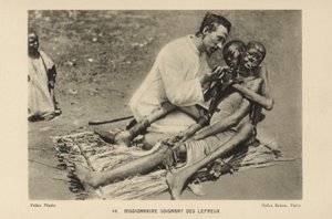 Missionar kümmert sich um Leprakranke von French Photographer