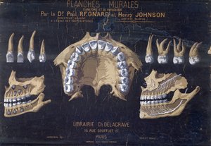 Anatomisches Wandbild der Zähne