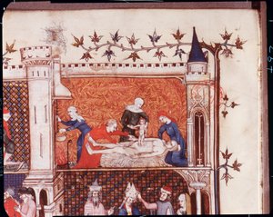 Geburt von Julius Caesar, früheste bekannte Darstellung eines Kaiserschnitts