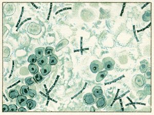 Anthrax-Bakterien im Blut, ca. 1890
