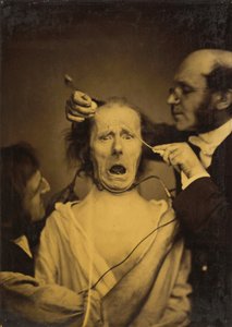 Terror gemischt mit Schmerz, Folter von Guillaume Benjamin Amant Duchenne
